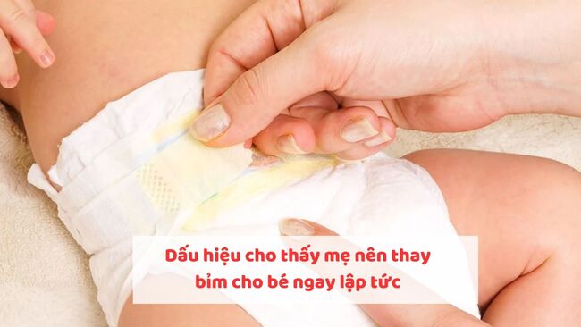 Dấu hiệu cho thấy mẹ nên thay bỉm cho bé