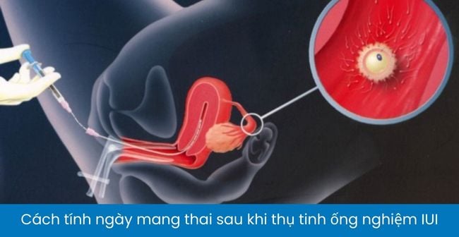 5. Cách tính ngày mang thai sau khi thụ tinh ống nghiệm IUI