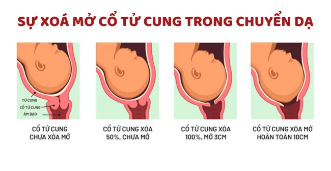 Đau bụng chuyển dạ diễn ra như thế nào?