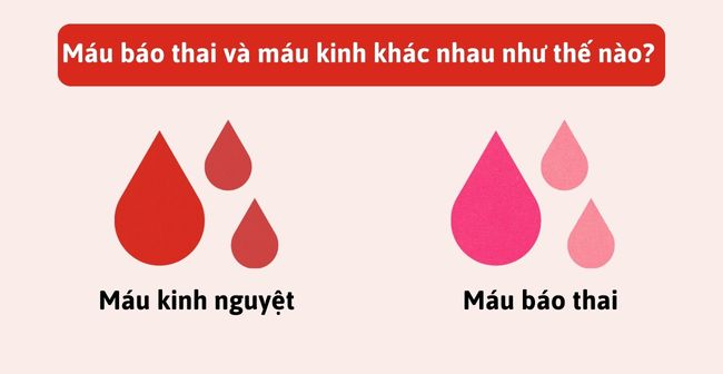 Máu báo thai và máu kinh nguyệt khác nhau thế nào?