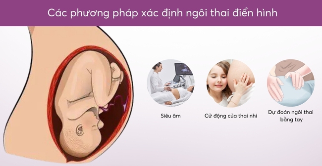 Dự đoán ngôi thai bằng tay