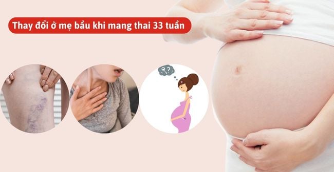 Ở tuần 33, mẹ bầu sẽ gặp các thay đổi như giãn tĩnh mạch, khó thở, hay quên