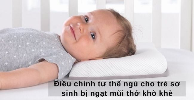 Điều chỉnh tư thế ngủ cho trẻ sơ sinh bị ngạt mũi thở khò khè