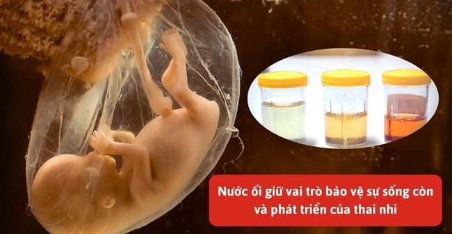 Nước ối là gì?