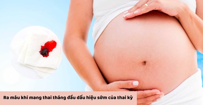 Hiện tượng ra máu khi mang thai tháng đầu là gì?