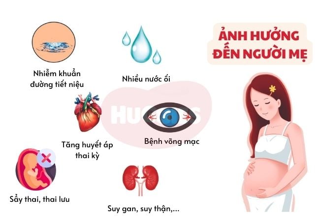 Biến chứng nguy hiểm bệnh tiểu đường thai kỳ với mẹ bầu